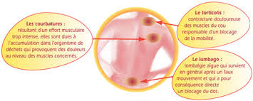 Troubles musculaires et articulaires