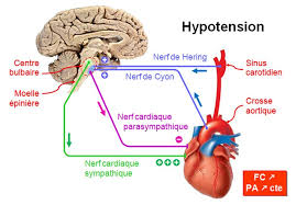 Hypotension